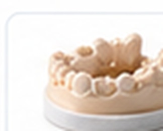 3D printed dental model