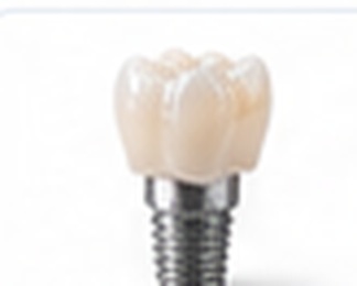 Implant crown restoration